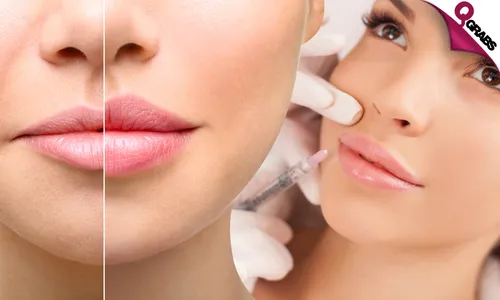 Botox Treatments for Lips, Eyes and more!